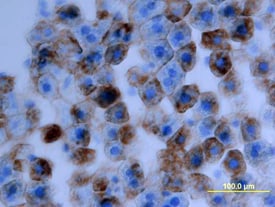 a2u-Globulin antibody in Rat Liver by Immunohistochemistry (IHC-Fr).