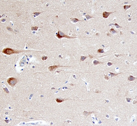 beta ‑Arrestin 2 antibody in Human Brain by Immunohistochemistry (IHC-P).