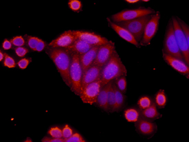 beta -Catenin antibody in SW480 Human Cell Line by Immunocytochemistry (ICC).
