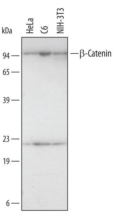 Detection of Human/Mouse/Rat  beta -Catenin antibody by Western Blot.