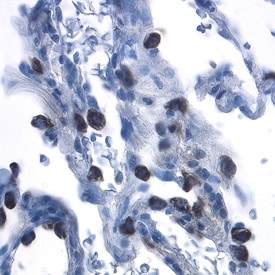 beta -Defensin 4/2 antibody in Human Lung by Immunohistochemistry (IHC-P).
