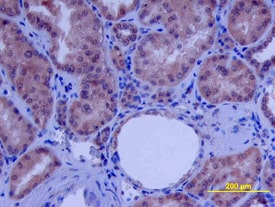beta -Defensin 4/2 antibody in Human Kidney Array by Immunohistochemistry (IHC-P).