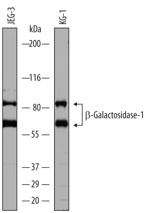 Detection of Human  beta -Galactosidase-1/GLB1 antibody by Western Blot.