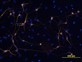 beta -III Tubulin antibody in Rat Cortical Stem Cells by Immunocytochemistry (ICC).