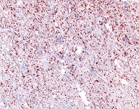 beta -NGF antibody in Rat Brain by Immunohistochemistry (IHC-Fr).