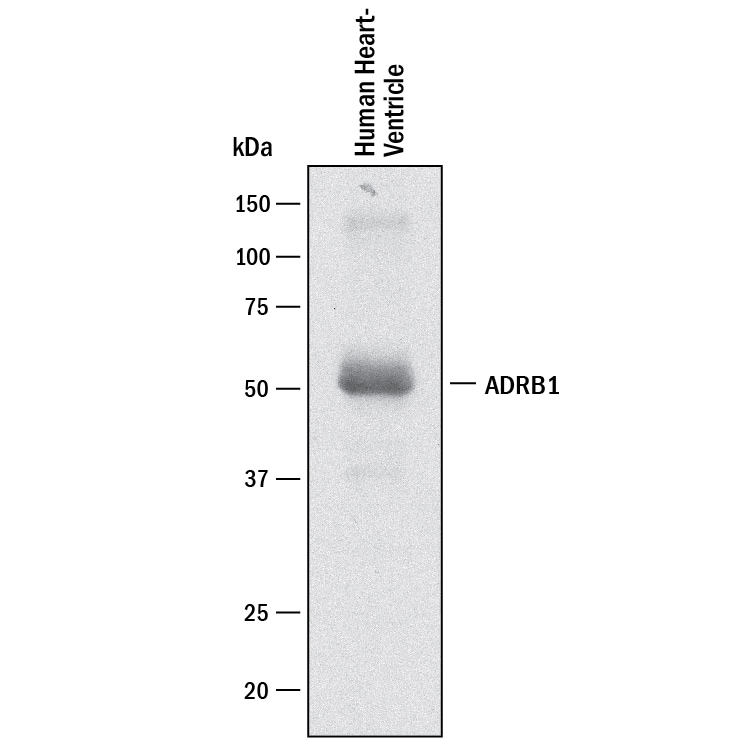 Detection of Human  beta -1 Adrenergic R/ADRB1 antibody by Western Blot.