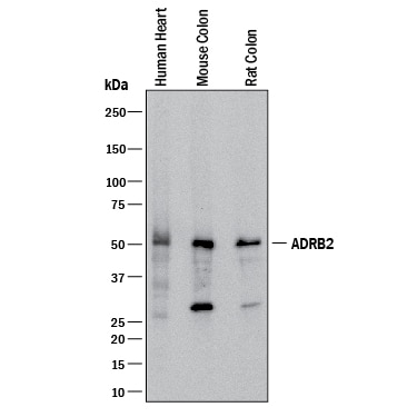 Detection of Human, Mouse, and Rat  beta -2 Adrenergic R/ADRB2 antibody by Western Blot.