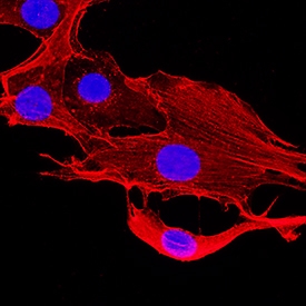 beta -Actin antibody in NIH-3T3 Mouse Cell Line by Immunocytochemistry (ICC).