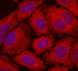 beta -Actin antibody in HeLa Human Cell Line by Immunocytochemistry (ICC).