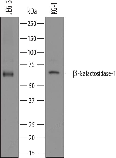 Detection of Human  beta -Galactosidase-1/GLB1 antibody by Western Blot.