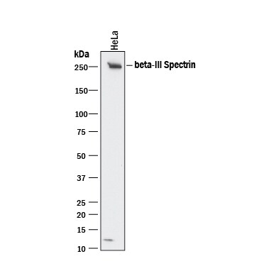 Detection of Human beta-III Spectrin antibody by Western Blot.