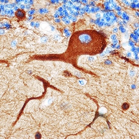beta -III Tubulin antibody in Human Brain by Immunohistochemistry (IHC-P).
