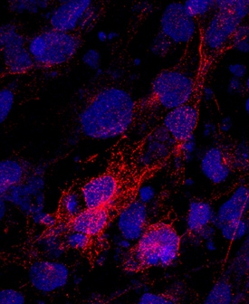 beta -I Tubulin antibody in BG01V Human Embryonic Stem Cells by Immunocytochemistry (ICC).