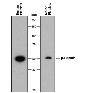 Detection of Human and Mouse  beta -I Tubulin antibody by Western Blot.