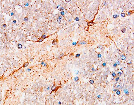 beta -NGF antibody in Human Brain by Immunohistochemistry (IHC-P).