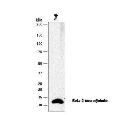 Detection of Human  beta 2-Microglobulin antibody by Western Blot.
