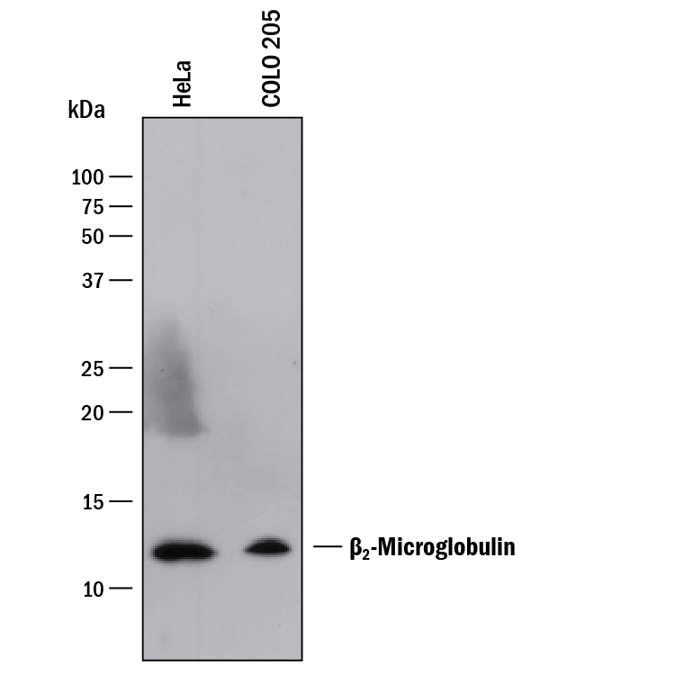 Detection of Human  beta 2-Microglobulin antibody by Western Blot.