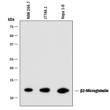 Detection of Mouse  beta 2-Microglobulin antibody by Western Blot.