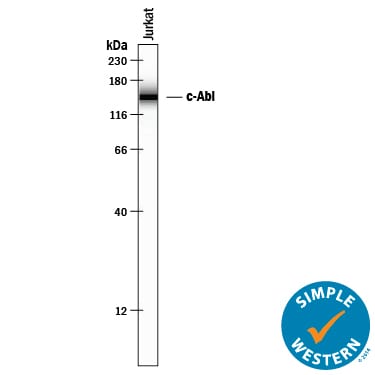 Detection of Human c‑Abl antibody by Simple WesternTM.