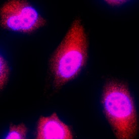 c-Fos antibody in HeLa Human Cell Line by Immunocytochemistry (ICC).