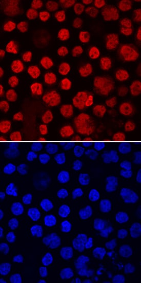 c-Maf antibody in RPMI 8226 Human Cell Line by Immunocytochemistry (ICC).