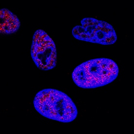 c-Myc antibody in HeLa Human Cell Line by Immunocytochemistry (ICC).