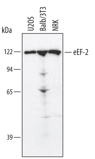 Detection of Human/Mouse/Rat eEF‑2 antibody by Western Blot.