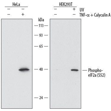 Detection of Human Phospho-eIF2a (S52) antibody by Western Blot.