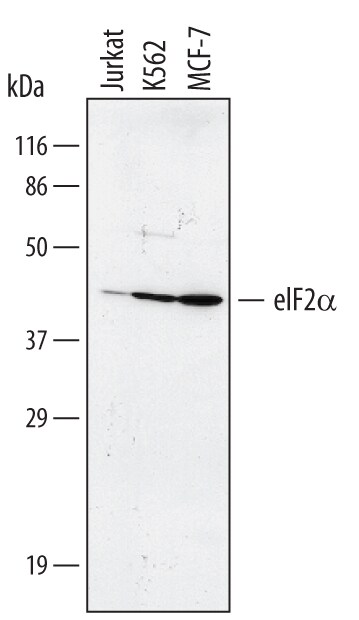Detection of Human eIF2a antibody by Western Blot.