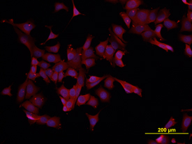 eIF4E antibody in MCF-7 Human Cell Line by Immunocytochemistry (ICC).