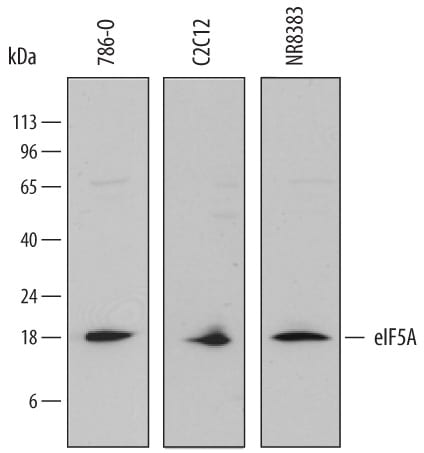 Detection of Human, Mouse, and Rat eIF5A antibody by Western Blot.