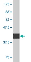 CLIC5 Antibody (1E6) - Azide and BSA Free