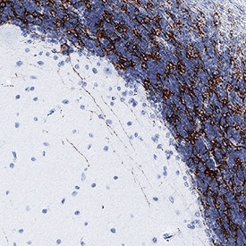 mGluR2 antibody in Human Brain by Immunohistochemistry (IHC-P).
