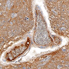 mGluR4 antibody in Human Endothelial Cells by Immunohistochemistry (IHC-P).