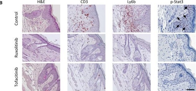 Detection of IgG1 by Immunohistochemistry