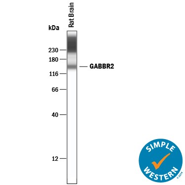 Detection of Rat GABAB R2 antibody by Simple WesternTM.