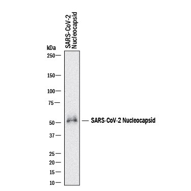 Detection of SARS-CoV-2 Nucleocapsid antibody by Western Blot.
