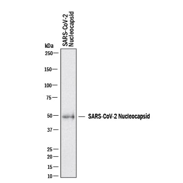 Detection of SARS-CoV-2 Nucleocapsid antibody by Western Blot.