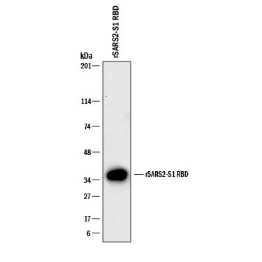 Detection of SARS-CoV-2 Spike RBD antibody by Western Blot.
