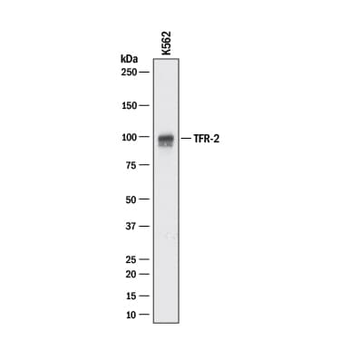 Detection of Human TfR2 antibody by Western Blot.