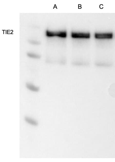 Detection of Human Tie‑2 by Western Blot.