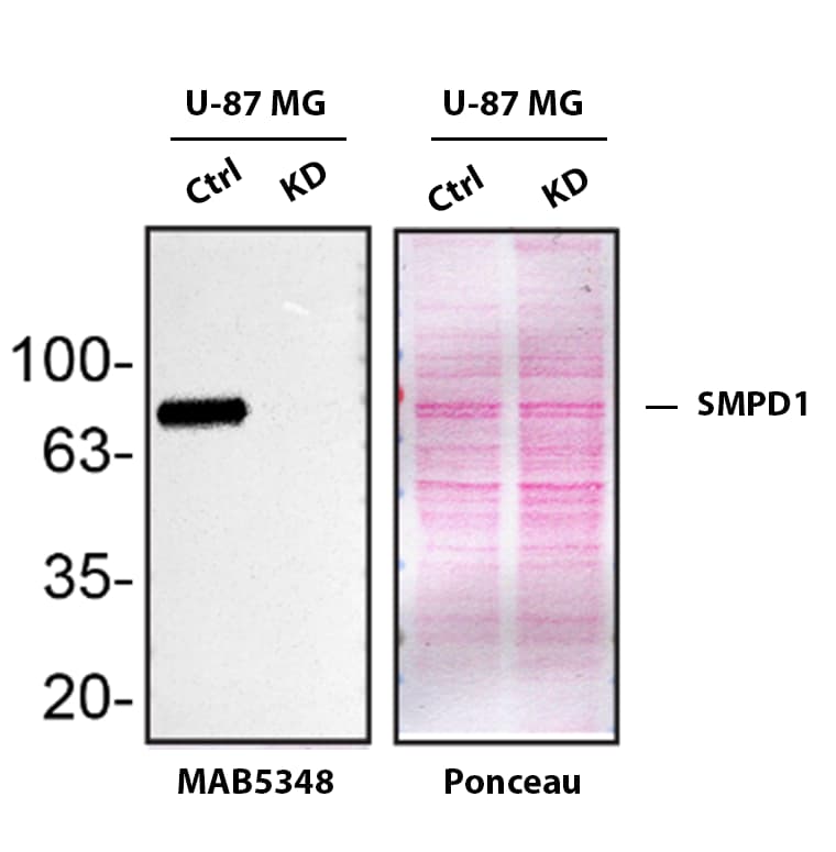 Western Blot Shows SMPD1 Specificity Using Knockdown Cell Line.