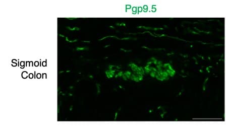 UCH-L1/PGP9.5 in Human Colon.