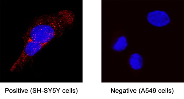 beta ‑1,3‑Glucuronyltransferase 1/B3GAT1 antibody in SH‑SY5Y Human Cell Line by Immunocytochemistry (ICC).