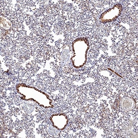 ACE‑2 antibody in Hamster Lung by Immunohistochemistry (IHC-P).
