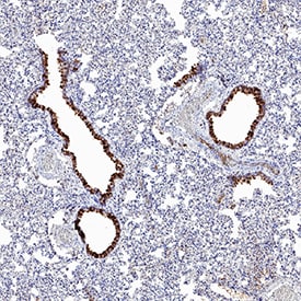 ACE‑2 antibody in Hamster Lung by Immunohistochemistry (IHC-P).