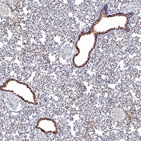 ACE‑2 antibody in Hamster Lung by Immunohistochemistry (IHC-P).