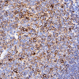 Human IgM Antibody