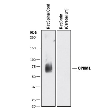 Detection of Rat µ Opioid R/OPRM1 antibody by Western Blot.