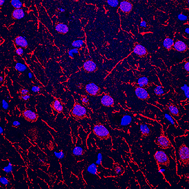 nNOS antibody in Rat Brain by Immunohistochemistry (IHC-Fr).